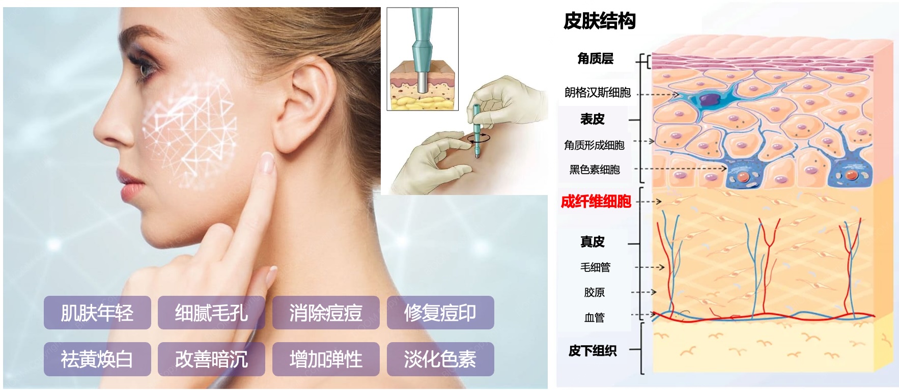 自体皮肤·成纤维细胞